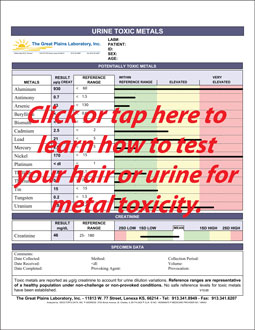 Test your urine or hair for copper toxicity.