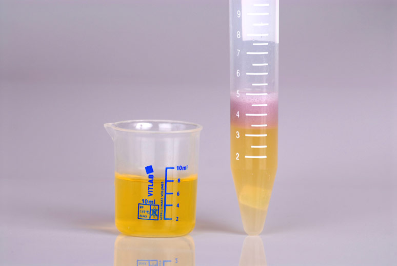 urine heavy metal test