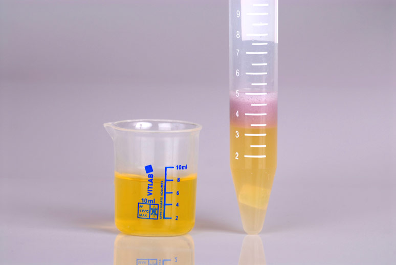 Heavy Metal Screening Test - Toxic in copper